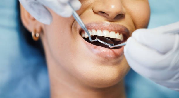 Best Chipped Tooth Repair Near Me  in Pine Lakes, FL